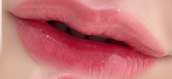 t3_image